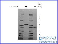 Novus Biologicals Recombinant Mouse Follistatin Protein 100 &mu;g | Buy Online | Novus Biologicals&trade; | Fisher Scientific